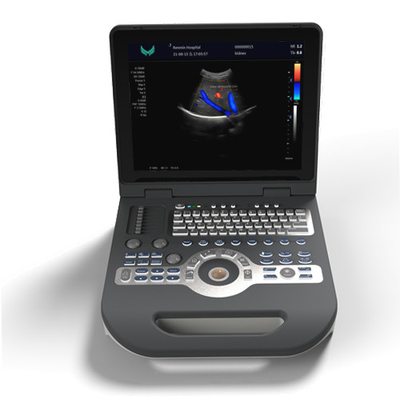 SGS Cardiology Color Ultrasound Scanner 220V มือถือ Doppler Ultrasound Device