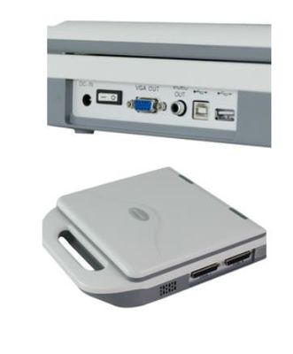 คุณภาพ  Digital Portable OB Gynecology Ultrasound Machine 12.1in LED 128 Images Storage โรงงาน