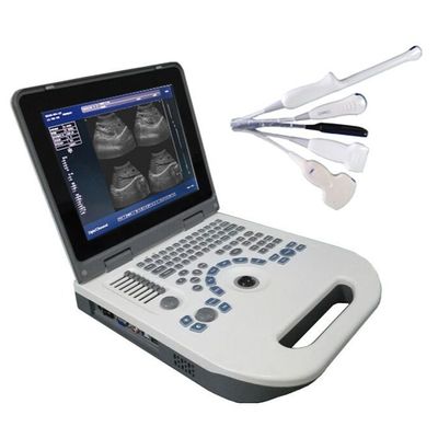 คุณภาพ  TGC Control Notebook Ultrasound Scanner For Pregnancy Home Use โรงงาน