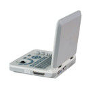 เครื่องฉีดเสียงแบบพกพา 15 นิ้ว LED สี มีมุมสแกน 60 องศาและจอลึก ≥ 250 มม