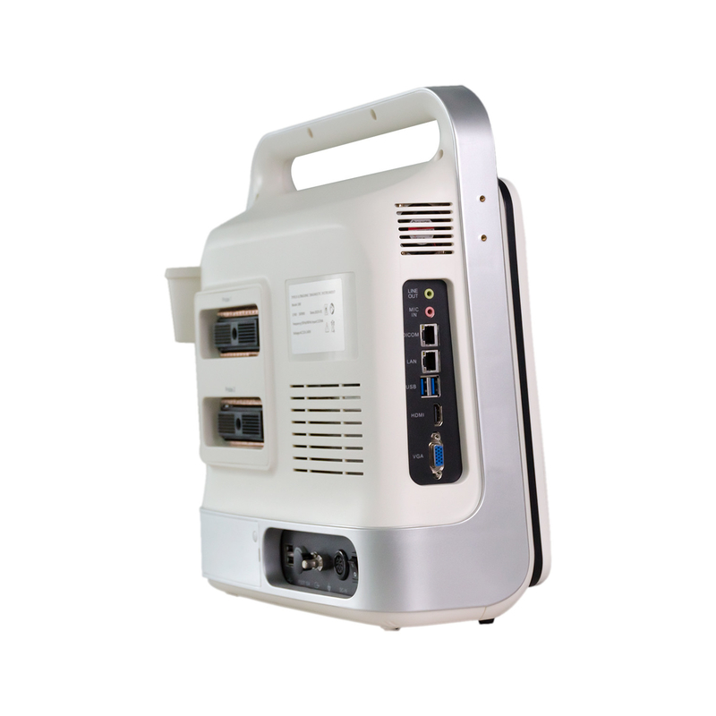 เครื่องอัลตราซาวด์ Doppler สีแล็ปท็อปแบบพกพาควบคุม TGC สำหรับทารกแรกเกิด Heart