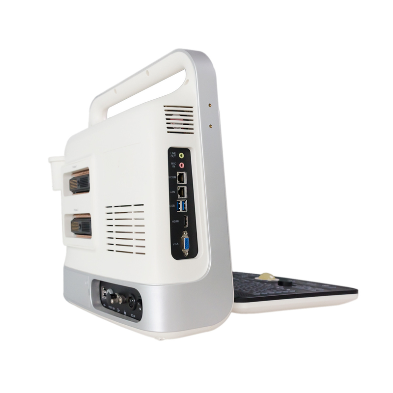 เครื่องอัลตราซาวด์ Doppler สีแล็ปท็อปแบบพกพาควบคุม TGC สำหรับทารกแรกเกิด Heart