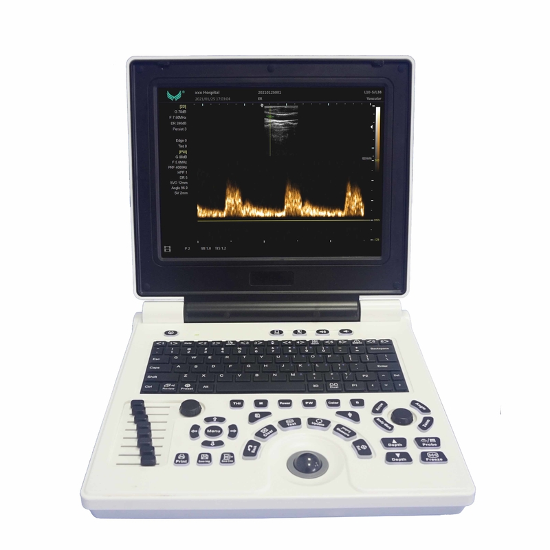OB GYN เครื่องอัลตราซาวด์ Doppler สีแบบพกพาในการตั้งครรภ์