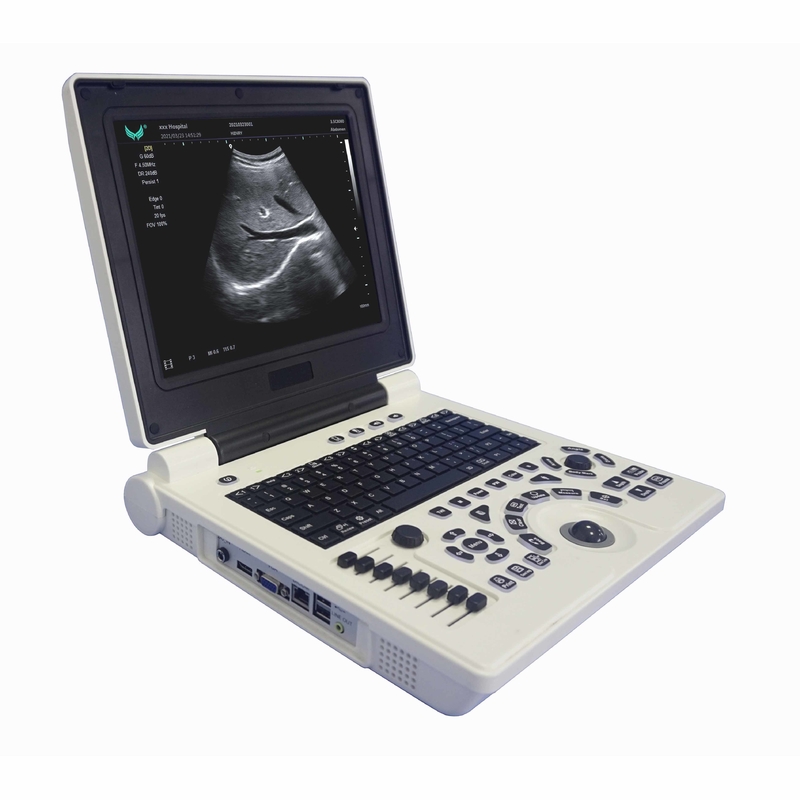 OB GYN เครื่องอัลตราซาวด์ Doppler สีแบบพกพาในการตั้งครรภ์