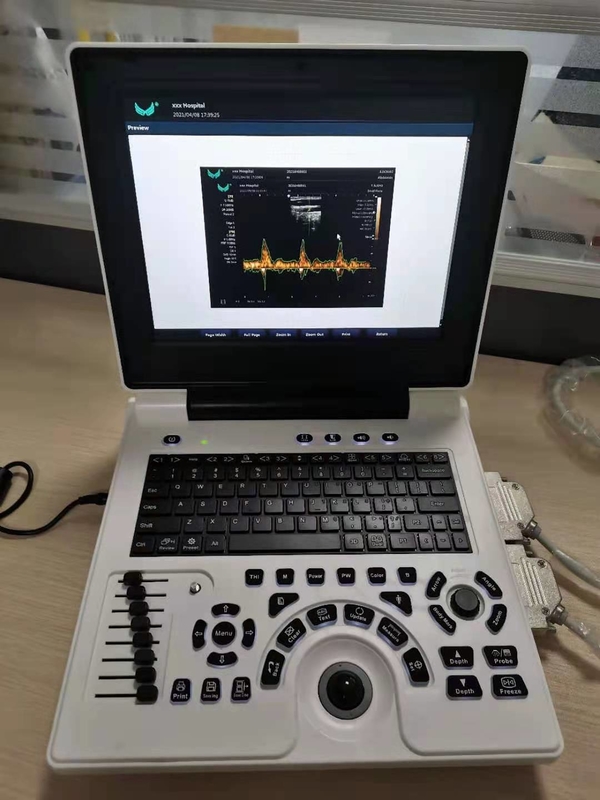 Xianfeng Pregnancy Color Doppler Ultrasound Machines รูปภาพ 4B OEM