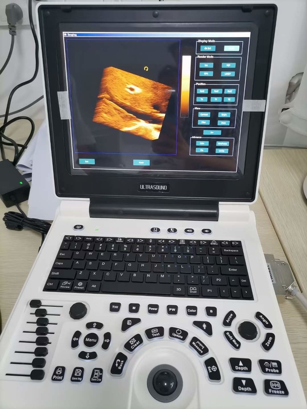 Xianfeng Pregnancy Color Doppler Ultrasound Machines รูปภาพ 4B OEM