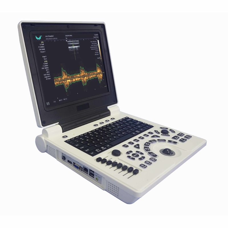 Xianfeng Pregnancy Color Doppler Ultrasound Machines รูปภาพ 4B OEM