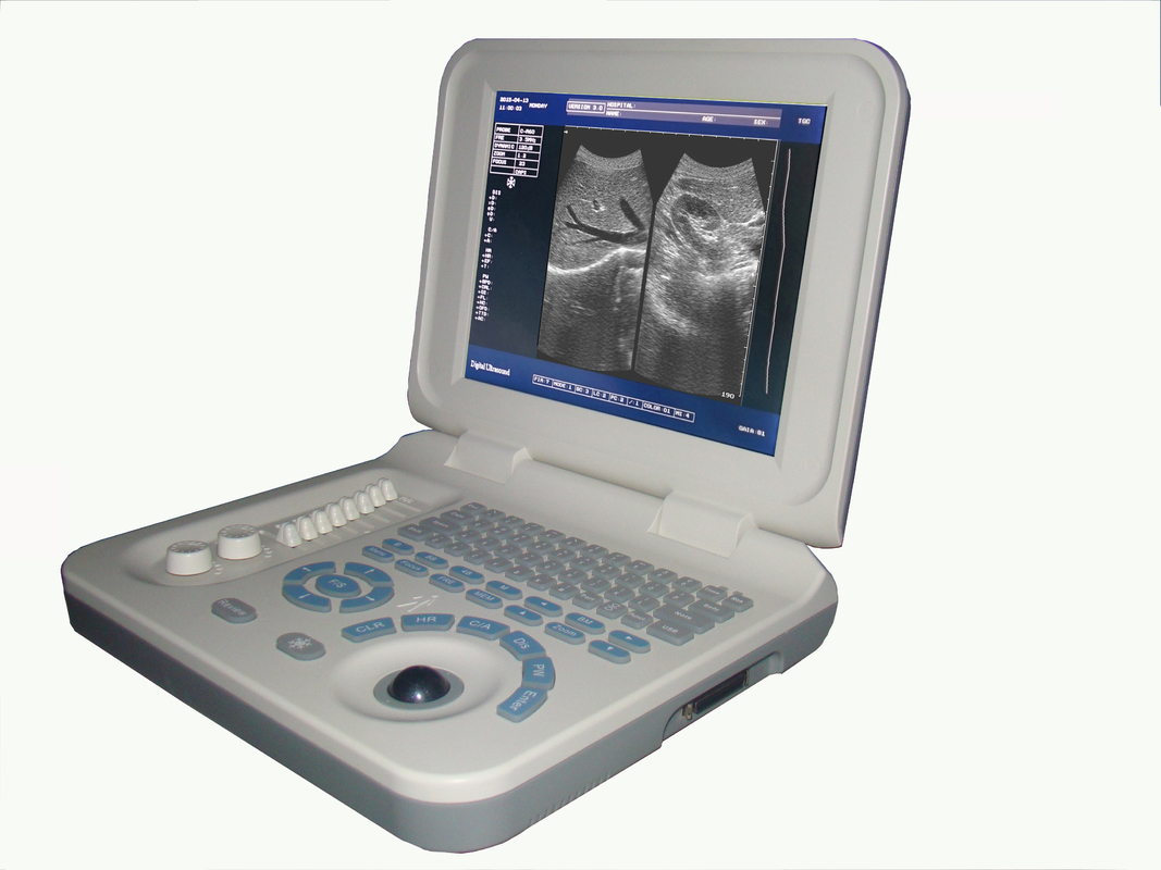 เครื่องสแกน HD USG ขนาด 10.4 นิ้ว Color Doppler Ultrasound Scanner เอาต์พุต SVGA