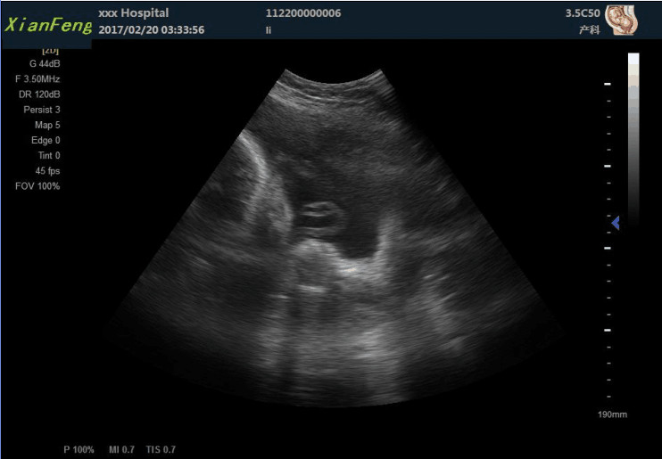 เครื่องสแกน HD USG ขนาด 10.4 นิ้ว Color Doppler Ultrasound Scanner เอาต์พุต SVGA