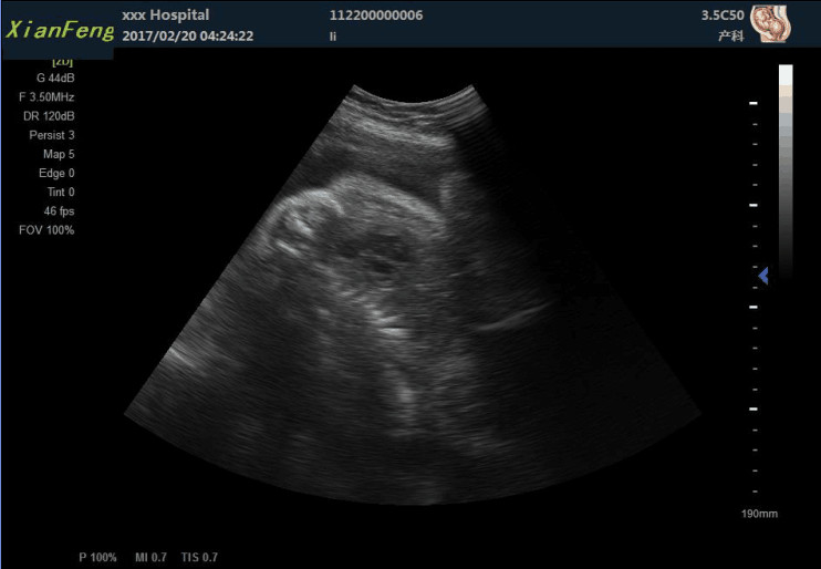เครื่องสแกน HD USG ขนาด 10.4 นิ้ว Color Doppler Ultrasound Scanner เอาต์พุต SVGA