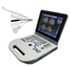 TGC Control Notebook Scanner เครื่องตรวจอัลตร้าซาวด์แล็ปท็อปสำหรับการตั้งครรภ์ที่บ้าน