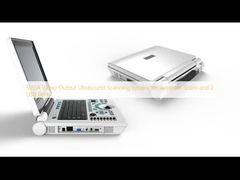 ระบบสแกนอัลตราซาวนด์เอาต์พุตวิดีโอ SVGA เพื่อการสแกนที่แม่นยำและพอร์ต USB 2 พอร์ต