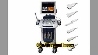 เครื่องตรวจอัลตร้าซาวด์ Doppler PW CFM PDI Mode