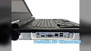 เครื่องอัลตราซาวนด์แบบพกพา E20 คลินิกรพ