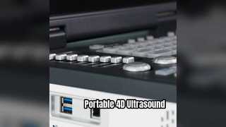 เครื่องอัลตราซาวด์ Doppler 4D แบบพกพาพร้อมห้องไอซียู