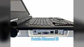 เครื่องอัลตราซาวนด์ Doppler สีแบบพกพา E0 สแกนระบบทางเดินปัสสาวะ